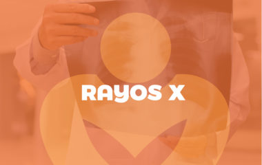 Rayos X